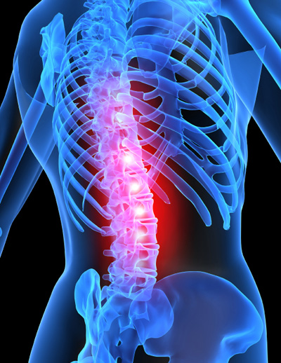 osteoporosis-therapy-dover-russellvile